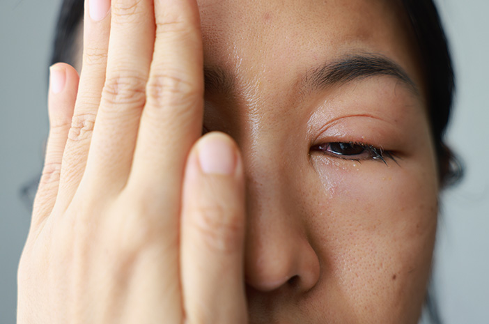 Gangguan Pada Mata: Penyebab Dan Cara Mengatasinya