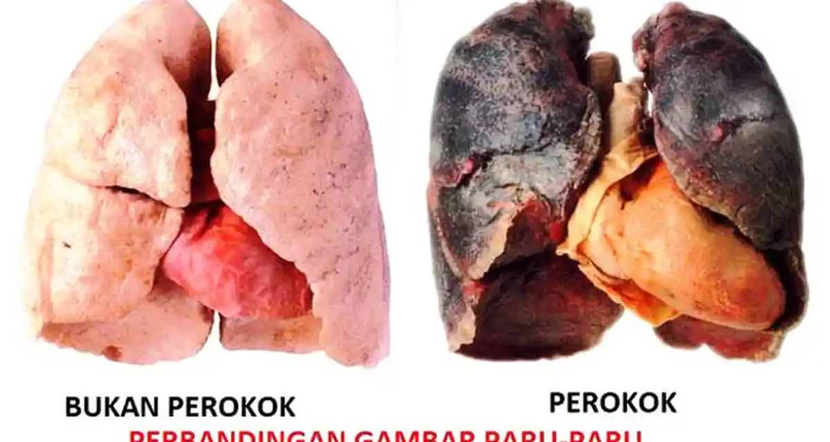 Bahaya Rokok Terhadap Paru-Paru: Fakta Yang Harus Diketahui