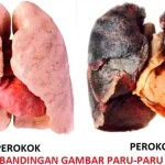 Bahaya Rokok Terhadap Paru-Paru: Fakta Yang Harus Diketahui