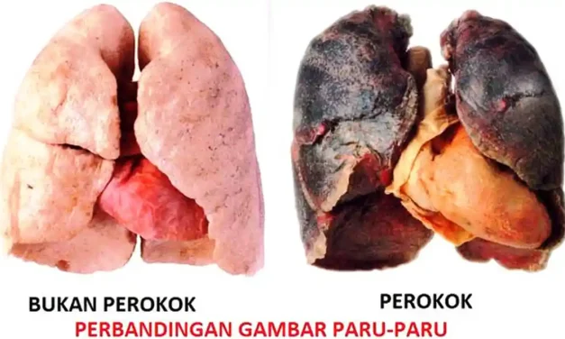 Bahaya Rokok Terhadap Paru-Paru: Fakta Yang Harus Diketahui