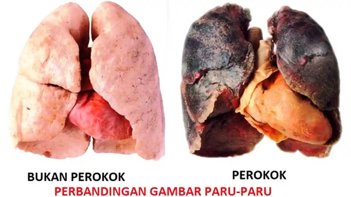 Bahaya Rokok Terhadap Paru-Paru: Fakta Yang Harus Diketahui